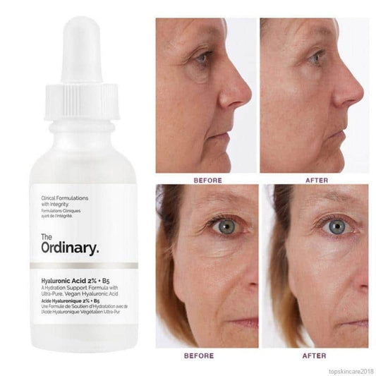 THE ORDINARY HYALURONIC ACID 2% + B5 30ML - интенсивное увлажнение и упругая кожа